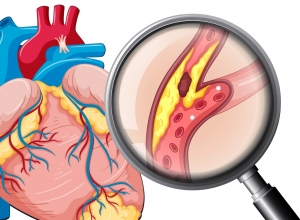 Cảnh báo 6 tác nhân gây hại dến tim mạch mà mọi người cần dặc biệt lưu ý
